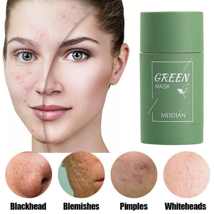 Revitalize Your Skin with Our Green Tea Solid Cleansing Mask - The Ultimate Acne & Blemish Treatment for a Radiant Complexion
