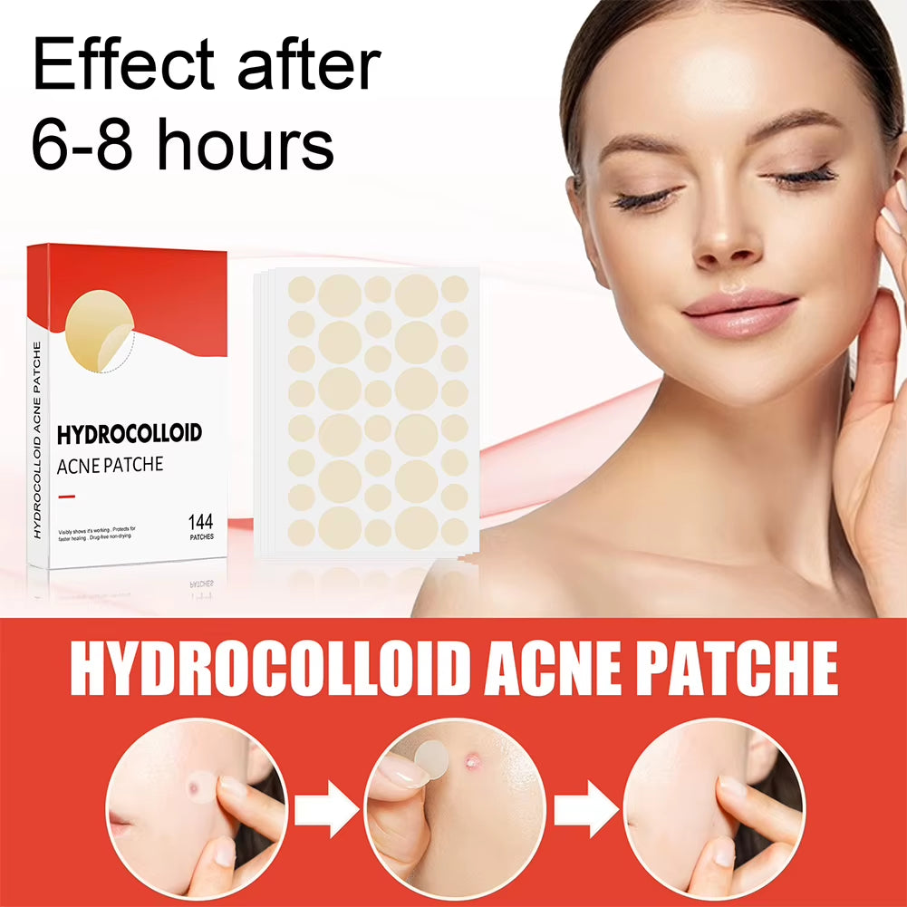 144Pcs/Set Face Skin Care Acne Pimple Patch 2 Sizes Invisible Professional Healing Absorbing Spot Sticker Covering for Men Women